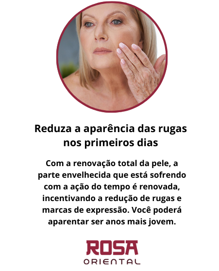 Inserir um título (50)